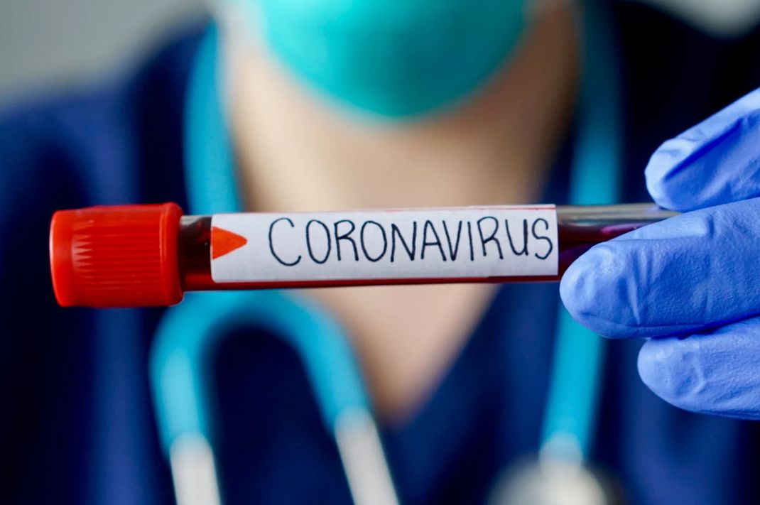 Два года с COVID в организме: у калужанки – самый долгий случай в мире.

По данным телеканала Ник...